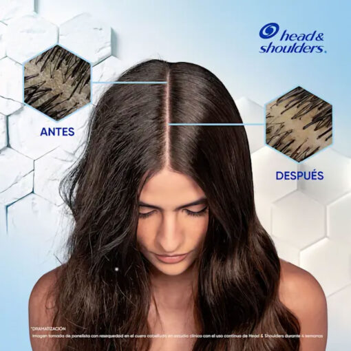 Shampoo Head & Shoulders  Anti Resequedad X 180 Ml - Imagen 6