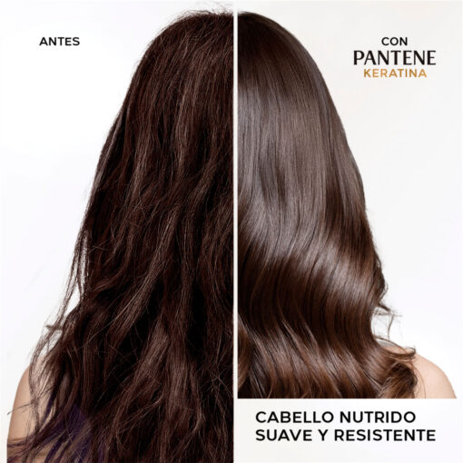 Shampoo Pantene Pro V Miracles  X 510 Ml - Imagen 7