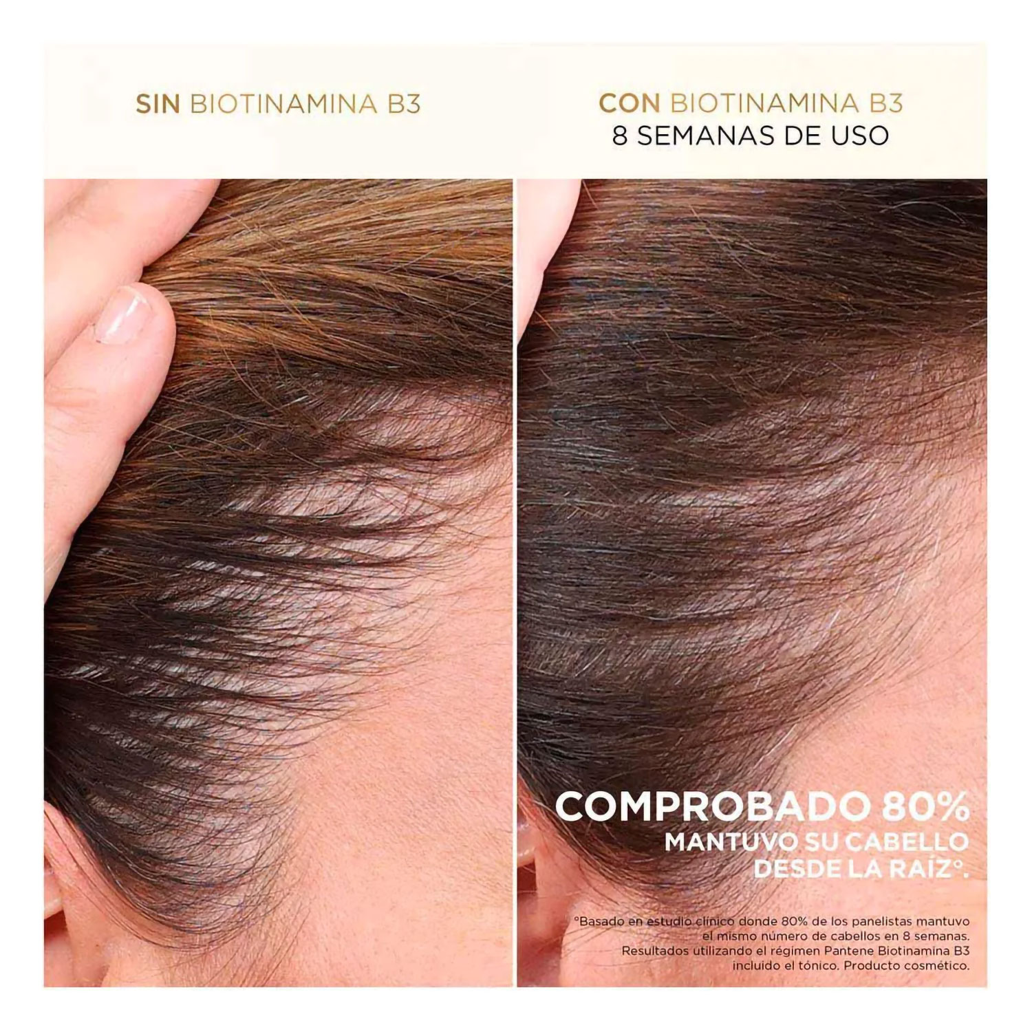 Shampoo Pantene Pro V Miracles Anti Caída X 510 Ml - Imagen 6